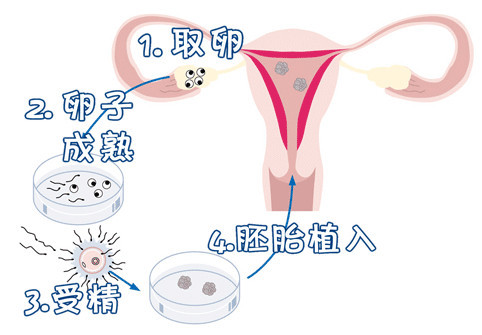 液氮存储